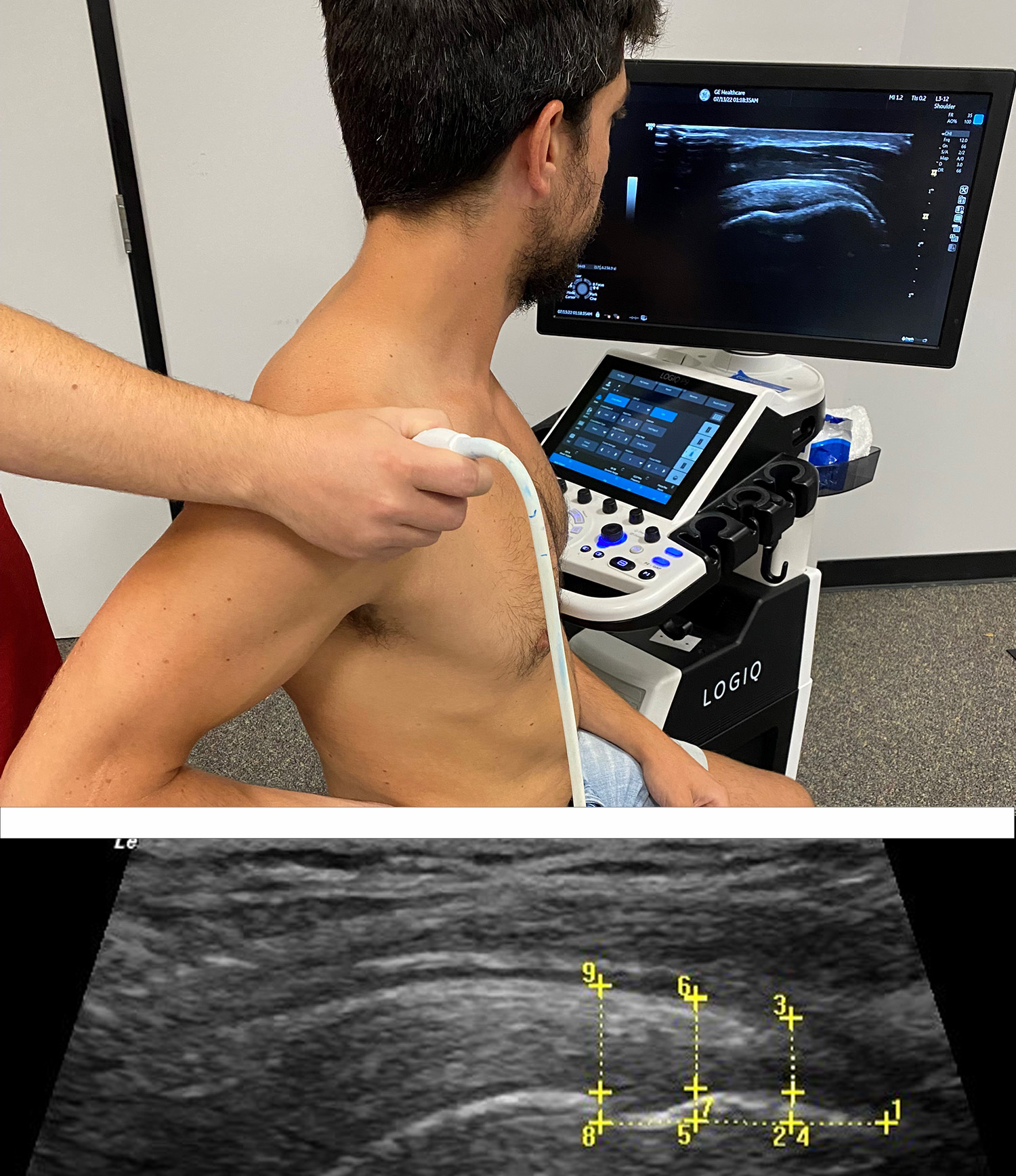 Ultrasounding a shoulder with ultrasound image below